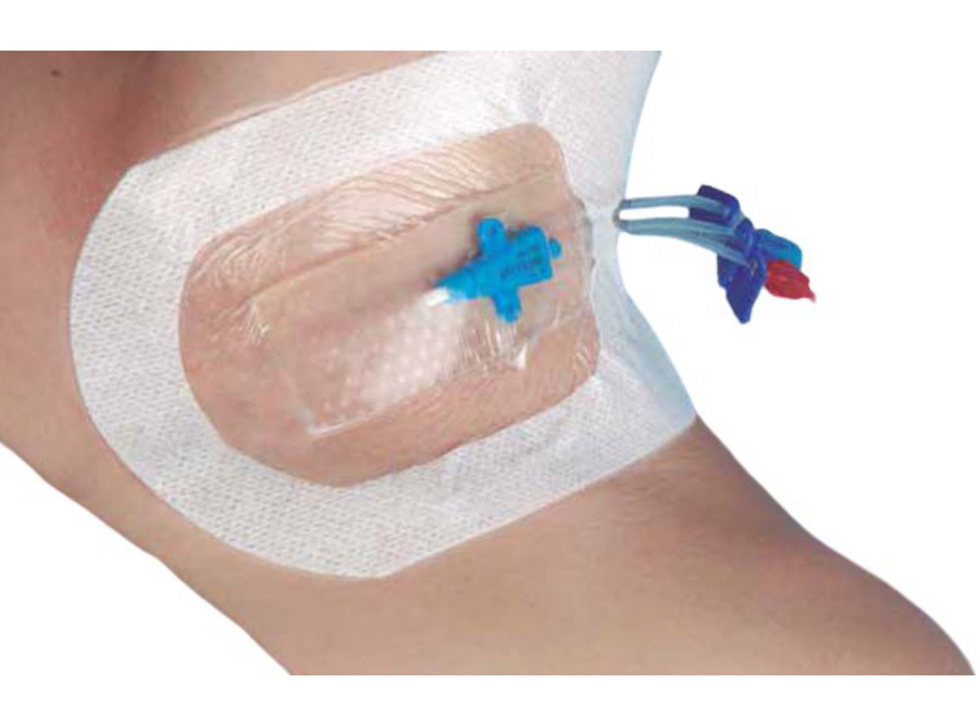  APOSITO TRANSPARENTE C/CHG IV 8.5X11.5CM 25UD FIXA 